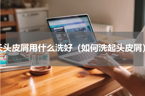 长头皮屑用什么洗好（如何洗起头皮屑）