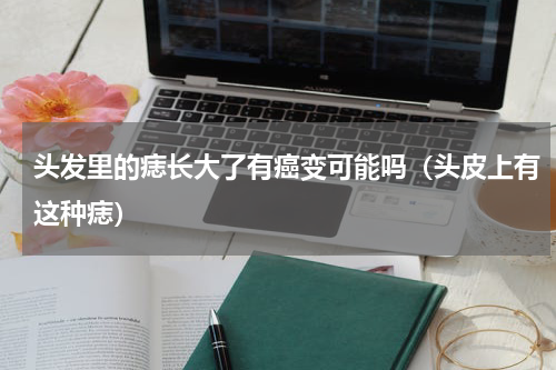 头发里的痣长大了有癌变可能吗（头皮上有这种痣）